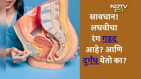 Urinary Tract Infection Causes: लघवी करताना जळजळ होते, वारंवार पण थोडीच लघवी होते? वाचा उपाय आयुर्वेदिक उपाय Urinary Tract Infection Causes: लघवी करताना जळजळ होते, वारंवार पण थोडीच लघवी होते? वाचा उपाय आयुर्वेदिक उपाय