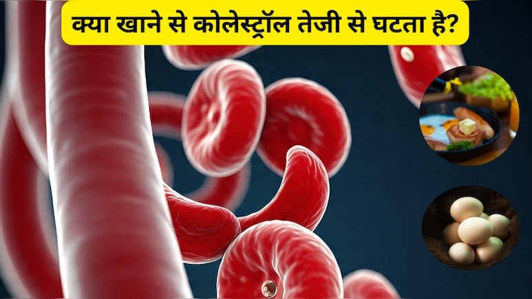 7 दिनों में कोलेस्ट्रॉल कैसे कम करें घरेलू उपाय? ये 10 सुपरफूड्स खाने से कोलेस्ट्रॉल तेजी से घट सकता है