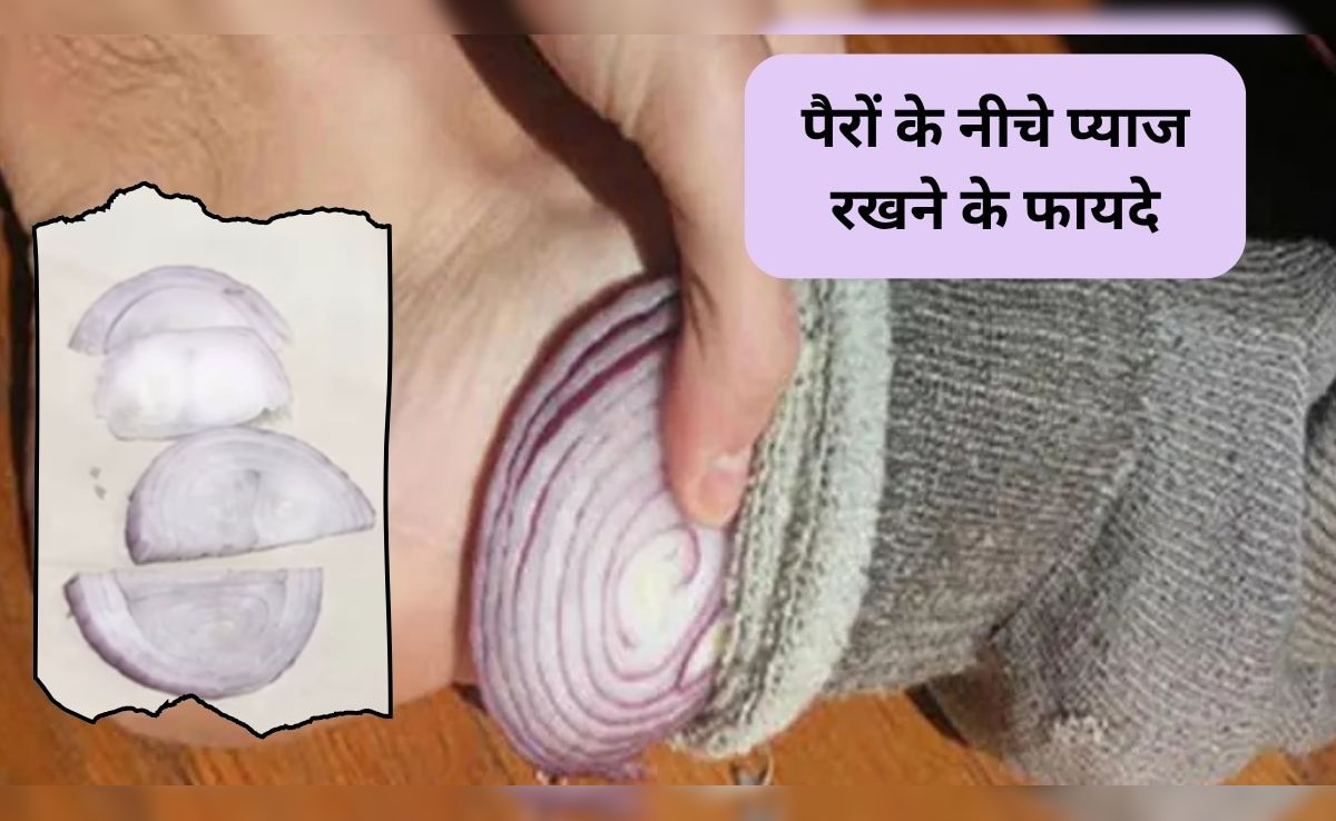Onion Therapy: सोने से पहले पैरों पर प्याज के टुकड़े रखने से क्या होता है? डायटीशियन से जानिए