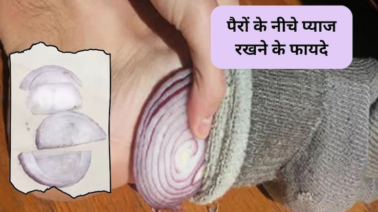 Onion Therapy: सोने से पहले पैरों पर प्याज के टुकड़े रखने से क्या होता है? डायटीशियन से जानिए