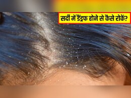 डैंड्रफ होने पर बालों को कितनी बार धोना चाहिए? डर्मेटोलॉजिस्ट ने बताया सर्दियों में डैंड्रफ से छुटकारा कैसे पाएं