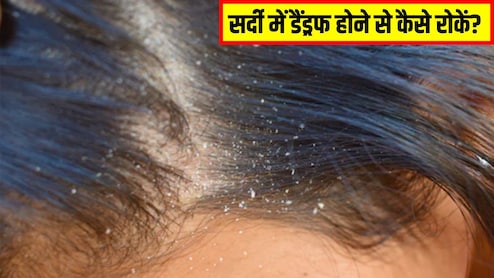डैंड्रफ होने पर बालों को कितनी बार धोना चाहिए? डर्मेटोलॉजिस्ट ने बताया सर्दियों में डैंड्रफ से छुटकारा कैसे पाएं
