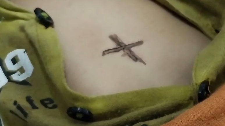 9 महीने के मासूम को गर्म चिमटे से दागने वाले माता-पिता के खिलाफ केस दर्ज, भोपा के पास बेटे को ले गए थे आरोपी