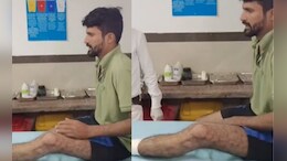 कुख्यात बदमाश बाहर से ताला लगवाकर घर में छिपा था, पुलिस को चकमा देकर ब्रिज से कूदा, टूट गया पैर &nbsp;