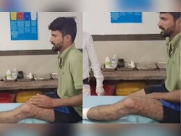 कुख्यात बदमाश बाहर से ताला लगवाकर घर में छिपा था, पुलिस को चकमा देकर ब्रिज से कूदा, टूट गया पैर  