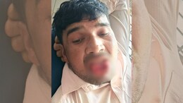 Married Man Tries To Forcibly Kiss Ex-Girlfriend, She Bites Off His Tongue