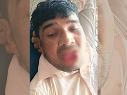 Married Man Tries To Forcibly Kiss Ex-Girlfriend, She Bites Off His Tongue