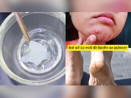 इन 5 तरीकों से करें 10 रुपये की वैसलीन का इस्तेमाल, पिंपल्स होंगे दूर, मुलायम हो जाएंगी एड़ियां