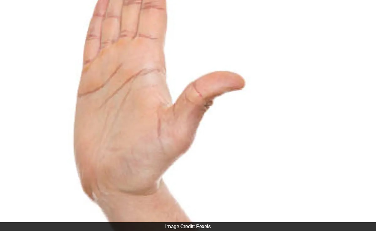 Chinese Martial Arts Star Suffers Broken Cheekbone In Global Power Slap Contest