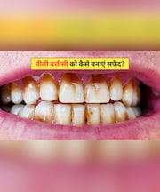 दांत क्यों हो जाते हैं पीले? दांतों के अंदर पीलापन कैसे साफ करें, डॉक्टर ने बताए सबसे आसान 4 घरेलू नुस्खे