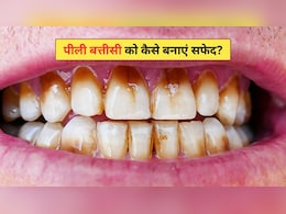 दांत क्यों हो जाते हैं पीले? दांतों के अंदर पीलापन कैसे साफ करें, डॉक्टर ने बताए सबसे आसान 4 घरेलू नुस्खे