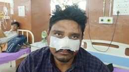 नाबालिग बच्चे ने पिता का नाक और प्राइवेट पार्ट काटा, गंभीर घायल; घरवाले बोले- पराई शक्ति