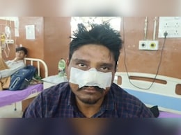 नाबालिग बच्चे ने पिता का नाक और प्राइवेट पार्ट काटा, गंभीर घायल; घरवाले बोले- पराई शक्ति