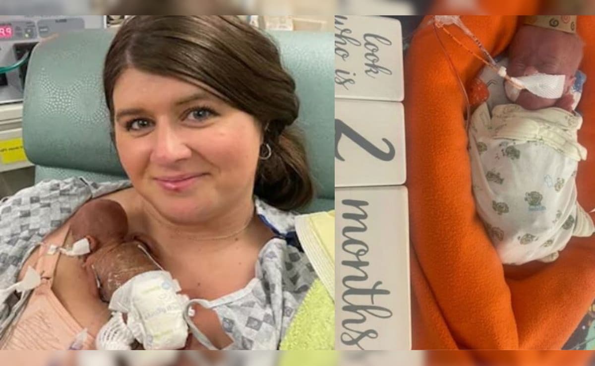 पैदा होते ही इस बच्चे का नाम गिनीज बुक में हुआ दर्ज, पहली बार देखकर डॉक्टर भी रह गए थे हक्के बक्के