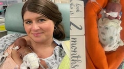 पैदा होते ही इस बच्चे का नाम गिनीज बुक में हुआ दर्ज, पहली बार देखकर डॉक्टर भी रह गए थे हक्के बक्के