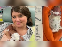 पैदा होते ही इस बच्चे का नाम गिनीज बुक में हुआ दर्ज, पहली बार देखकर डॉक्टर भी रह गए थे हक्के बक्के