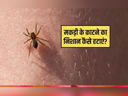 मकड़ी के काटने के कितने समय बाद लक्षण दिखाई देते हैं? मकड़ी काटने पर क्या लगाना चाहिए, मकड़ी के काटने का निशान कैसे हटाएं