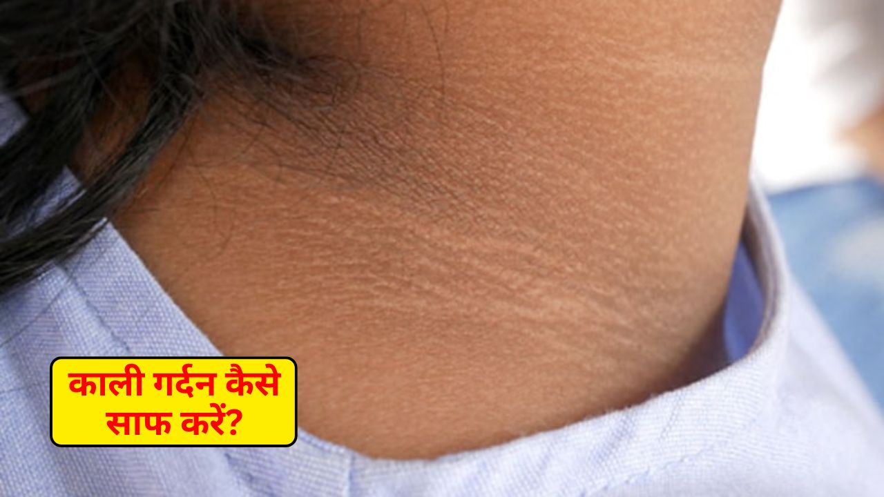 छिपाए नहीं छिप रहा गर्दन का कालापन? फ्रीज में रखी ये छोटी सी चीज करेगी कमाल, जान लें कैसे करें इस्तेमाल