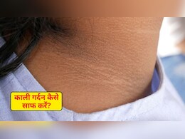 छिपाए नहीं छिप रहा गर्दन का कालापन? फ्रीज में रखी ये छोटी सी चीज करेगी कमाल, जान लें कैसे करें इस्तेमाल