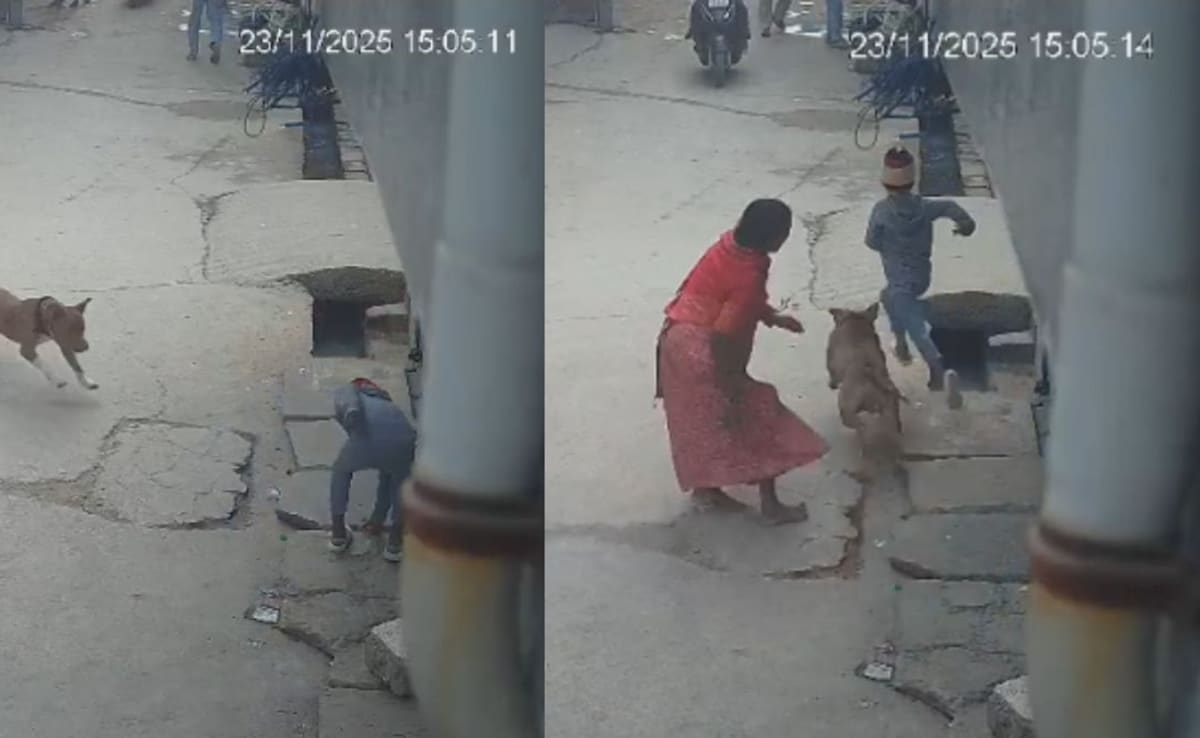 Delhi Boy Loses Ear In Shocking Pitbull Attack, Dog Owner Arrested
