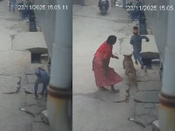Delhi Boy Loses Ear In Shocking Pitbull Attack, Dog Owner Arrested