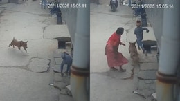 Delhi Boy Loses Ear In Shocking Pit Bull Attack, Dog Owner Arrested