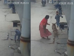 Delhi Boy Loses Ear In Shocking Pitbull Attack, Dog Owner Arrested