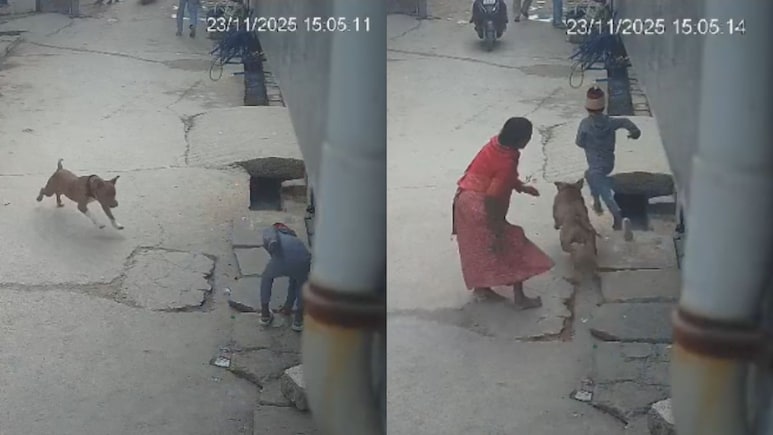 Delhi Boy Loses Ear In Shocking Pit Bull Attack, Dog Owner Arrested