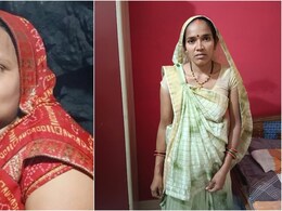 नसबंदी के दौरान दो महिलाओं की मौत, झटके लगे, शरीर अकड़ा और चली गई जान