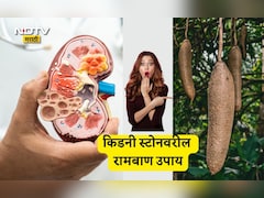Kidney Stones Treatment: मूतखड्यांच्या समस्येतून पटकन सुटका हवीय? या फळाचा काढा प्या, वाचा फायदे