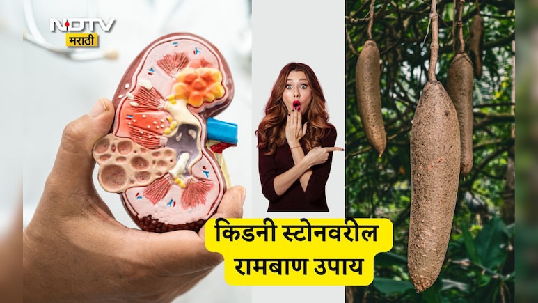 Kidney Stones Treatment: मूतखड्यांच्या समस्येतून पटकन सुटका हवीय? या फळाचा काढा प्या, वाचा फायदे