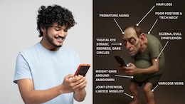 What Will A Phone Addict Look Like In 25 Years? AI Predicts Terrifying Hunchbacked-No Hair Future