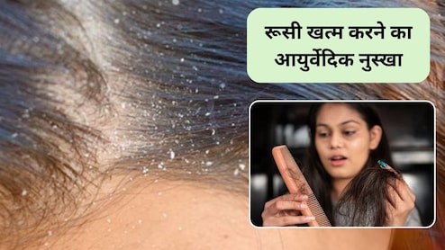 सर्दियों में रूसी बढ़ रही है? अपनाएं ये 5 आसान आयुर्वेदिक नुस्खे, हेल्दी और मजबूत हो जाएंगे बाल