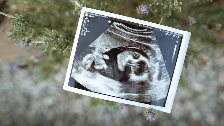 Controversy Erupts As US Startup Offers Opportunity To 'Genetically Optimise' Future Babies