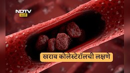 Bad Cholesterol Symptoms: बॅड कोलेस्टेरॉलला सायलेंट किलर का म्हणतात? जाणून घ्या लक्षणे आणि उपाय
