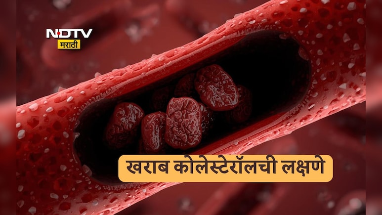 Bad Cholesterol Symptoms: बॅड कोलेस्टेरॉलला सायलेंट किलर का म्हणतात? जाणून घ्या लक्षणे आणि उपाय