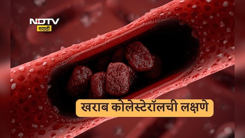 Bad Cholesterol Symptoms: बॅड कोलेस्टेरॉलला सायलेंट किलर का म्हणतात? जाणून घ्या लक्षणे आणि उपाय Bad Cholesterol Symptoms: बॅड कोलेस्टेरॉलला सायलेंट किलर का म्हणतात? जाणून घ्या लक्षणे आणि उपाय