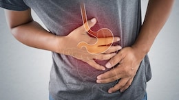 IBS Is Real But Commonly Misused As A Diagnosis; Here's What To Watch For