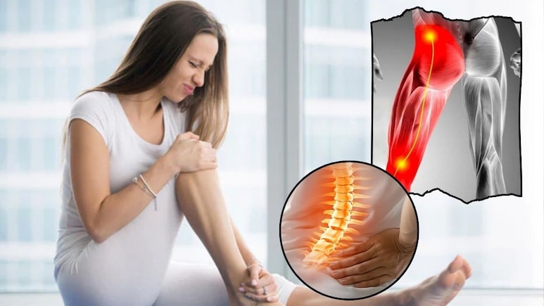 Home Remedy For Muscle Cramps: मसल्स में होती है ऐंठन, किस विटामिन की कमी से होती है मांसपेशियों में ऐंठन, ये घरेलू उपाय अकड़न को कर देगा गायब