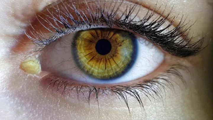 कौन से विटामिन की कमी से आंखों में ज्यादा कीचड़ आता है? डॉक्टर से जानें आंखों में सफेद कीचड़ क्यों आता है