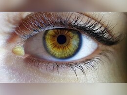 कौन से विटामिन की कमी से आंखों में ज्यादा कीचड़ आता है? डॉक्टर से जानें आंखों में सफेद कीचड़ क्यों आता है