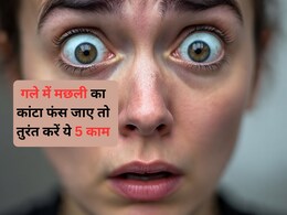 मछली खाते समय गले में कांटा फंस जाएं तो क्या करें? जानिए यहां 5 घरेलू उपाय