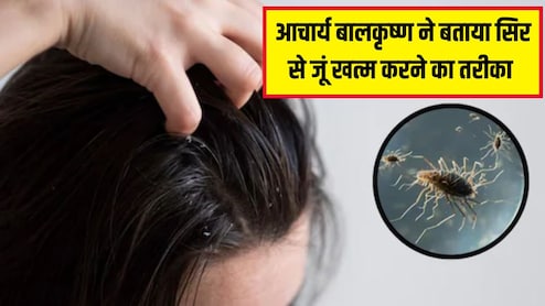 Acharya Balkrishna ने बताया सिर से जूं खत्म करने का असरदार नुस्खा, इसे लगाते ही हो जाएंगी ढेर