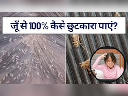 जूँ से 100% कैसे छुटकारा पाएं? घने हैं बच्‍चे के बाल, बार-बार हो जाती हैं जूं, जानें जू और लीख से छुटकारा पाने के घरेलू नुस्खे