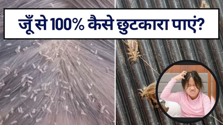 जूँ से 100% कैसे छुटकारा पाएं? घने हैं बच्‍चे के बाल, बार-बार हो जाती हैं जूं, जानें जू और लीख से छुटकारा पाने के घरेलू नुस्खे