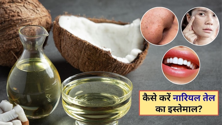 ब्लैकहेड्स होंगे गायब, मोती से चमक जाएंगे दांत, बस नारियल तेल को इन 4 तरीकों से ऐसे करें इस्तेमाल