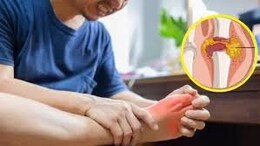 Uric Acid वाढले? डॉक्टरांनी सांगितले 3 नैसर्गिक उपाय, सर्व त्रासांपासून होईल सुटका