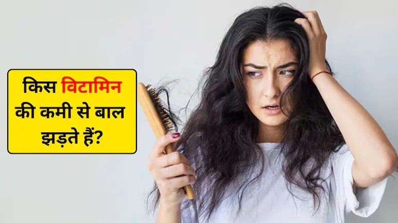 कौन से विटामिन की कमी से बाल झड़ते हैं? जानिए कौन सा तेल लगाने से बाल झड़ना बंद हो जाता है