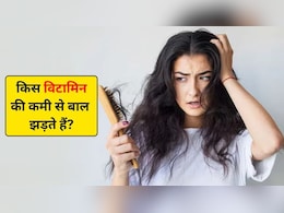 कौन से विटामिन की कमी से बाल झड़ते हैं? जानिए कौन सा तेल लगाने से बाल झड़ना बंद हो जाता है