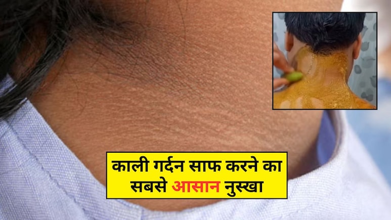 गर्दन पर मैल से दिखने लगी लाइनें? योग गुरु ने बताया असरदार घरेलू नुस्खा, साफ हो जाएगी स्किन